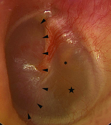 FIG 4.