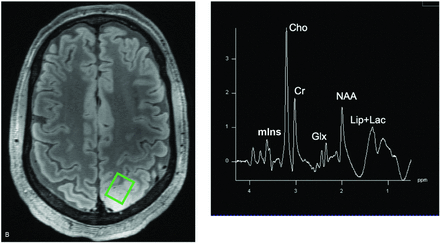 FIG 1.