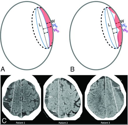 FIG 2.