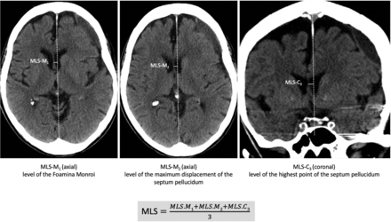 FIG 3.