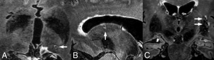 FIG 1.