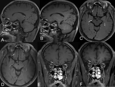 FIG 3.