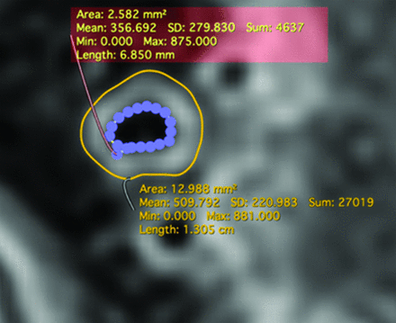FIG 1.