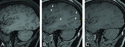 FIG 2.
