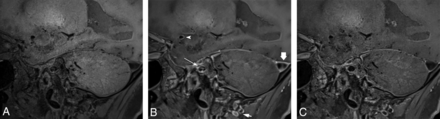 FIG 3.