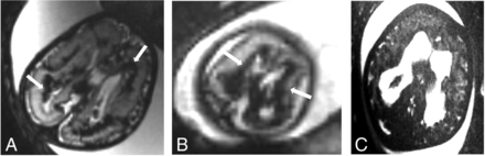 FIG 2.