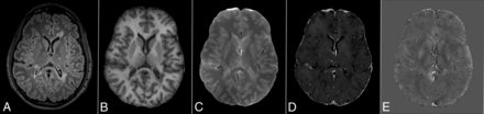 FIG 1.