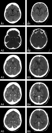 FIG 1.