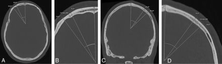 FIG 3.