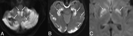 FIG 2.