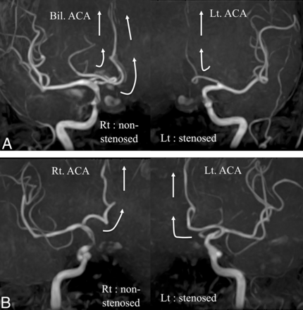 FIG 2.