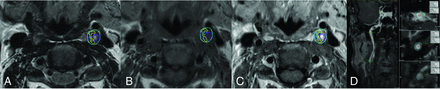 FIG 2.
