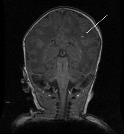 FIG 1.