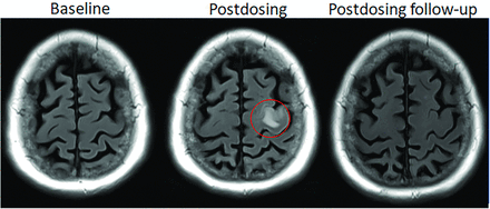 FIG 1.