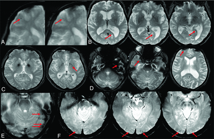FIG 8.