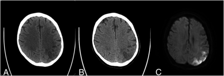 FIG 3.