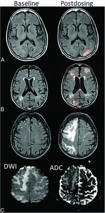 FIG 2.