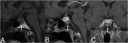 FIG 2.