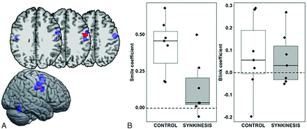 FIG 2.