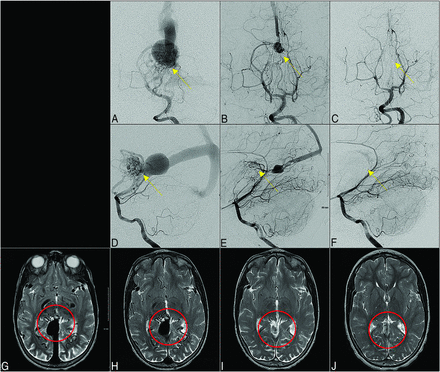 FIG 4.
