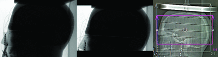 FIG 2.