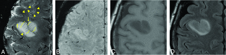 FIG 1.
