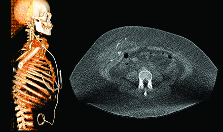 FIG 3.