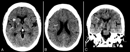 FIG 3.