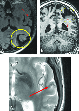 FIG 3.