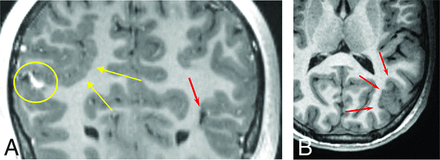 FIG 4.