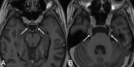 FIG 5.