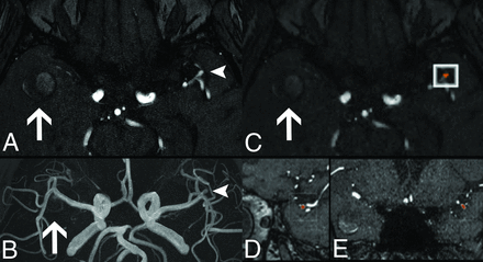 FIG 3.