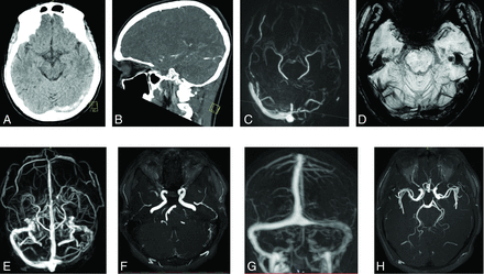 FIG 3.