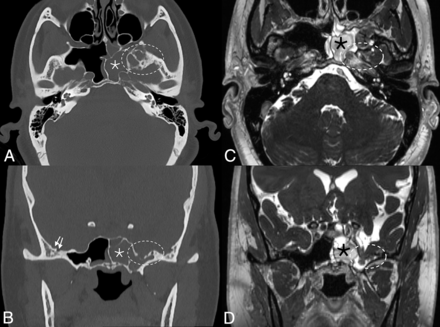 FIG 2.