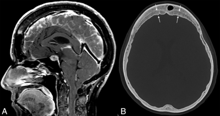 FIG 3.