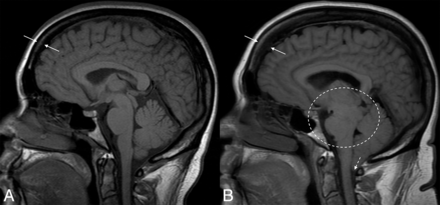 FIG 4.