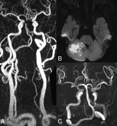 FIG 2.