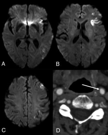 FIG 1.