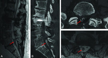 FIG 3.