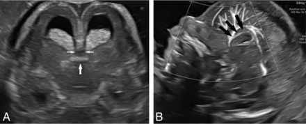 FIG 1.