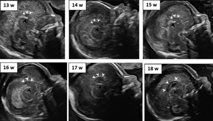 FIG 2.