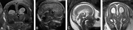 FIG 3.