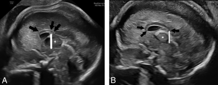 FIG 4.