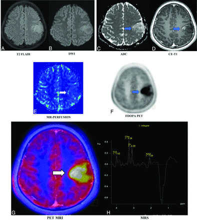 FIG 2.