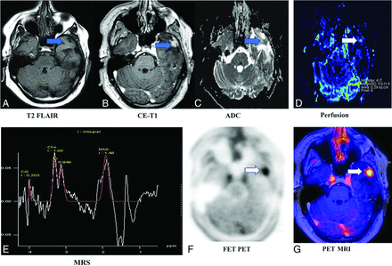 FIG 3.