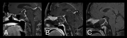 FIG 1.