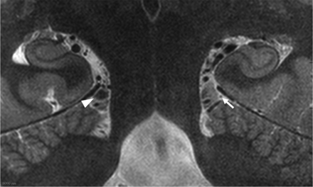 FIG 2.
