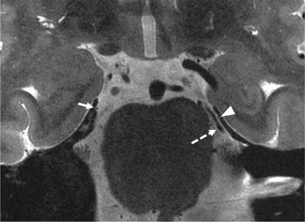 FIG 3.