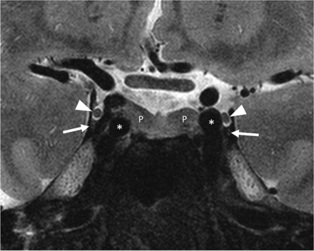 FIG 7.