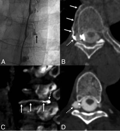 FIG 2.